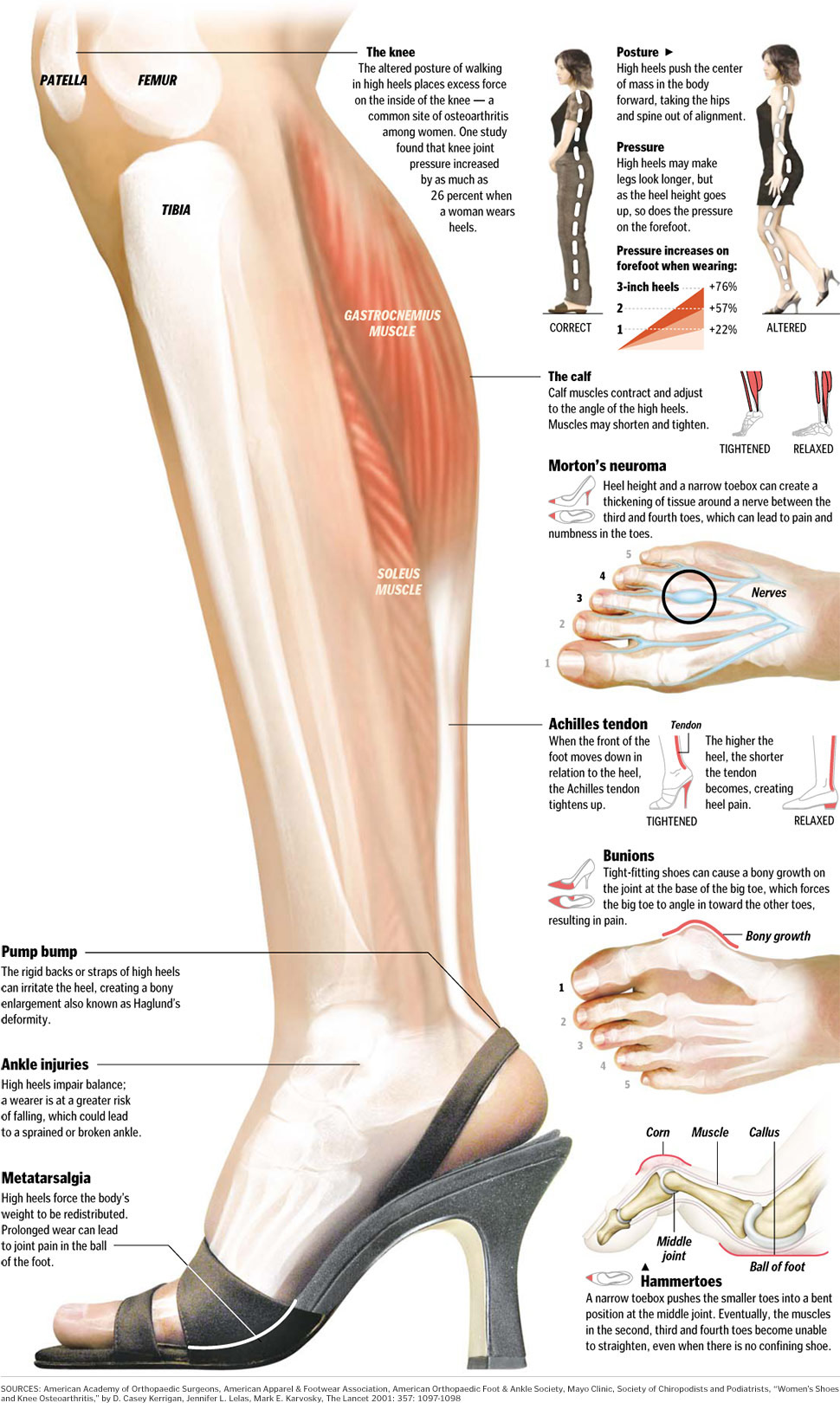 viscoform efectos tacon alto higiene postural dolor espalda english