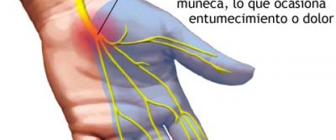 Ejercicios Síndrome del túnel carpiano